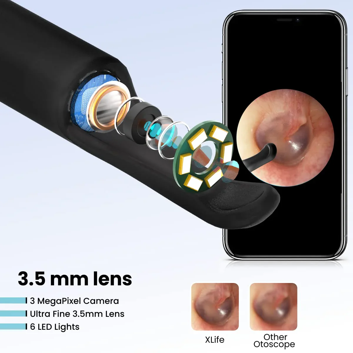 PORTRONICS Xlife Smart Wireless Ear Cleaning | Ultralight&Fine | 1080p Camera | 3.5mm Lens | 30 Min. Playtime - Image 2
